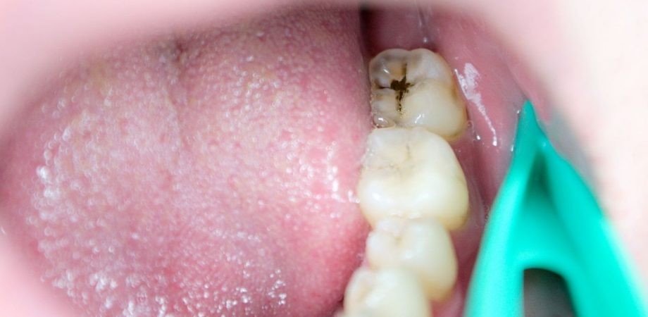 ‘Eu precisava muito do meu sorriso’; CRO-PE luta por garantia de direitos e democratização do acesso a serviços de odontologia para população