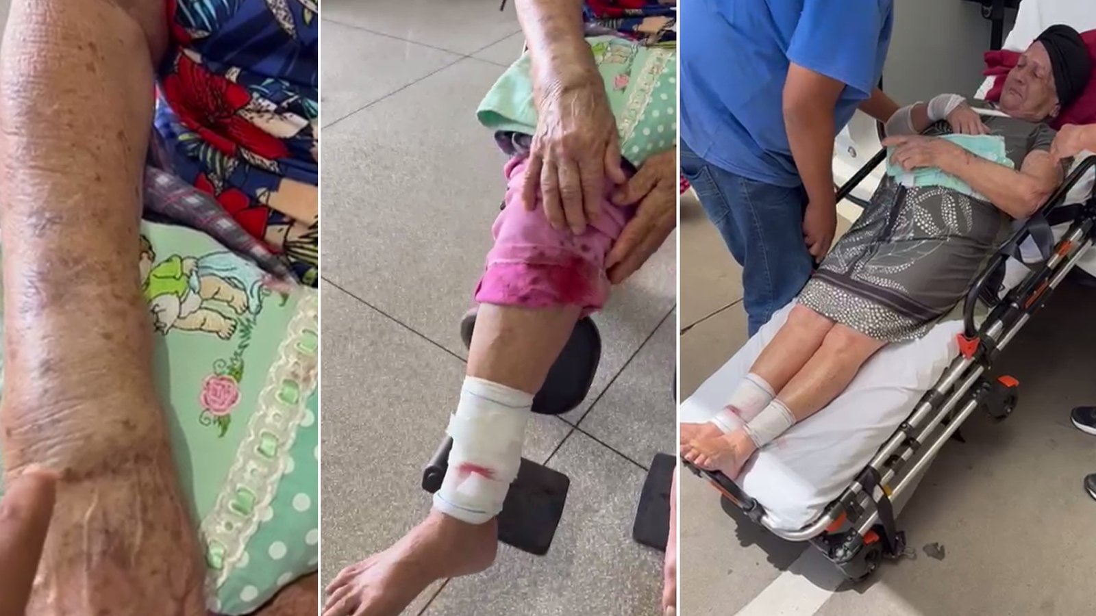 Idosa é atacada por cão que estava solto em rua de Riolândia