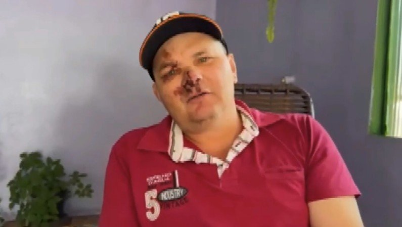 Trabalhador sobrevive após ficar por cerca de uma hora soterrado em obra no Paraná: ‘pessoal ia cavoucando e falando comigo’, relembra