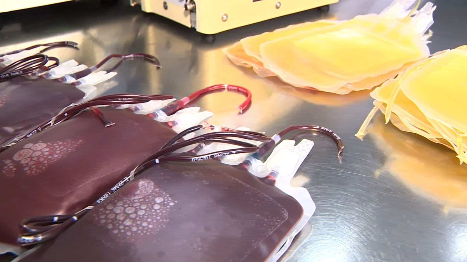 Com 4 tipos de sangue em níveis críticos, hospitais alertam para risco de adiamento de cirurgias em Campinas