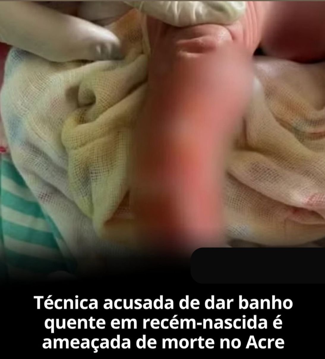 Técnica de enfermagem investigada por suposta queimadura em recém-nascida alega inocência e denuncia ameaças de morte