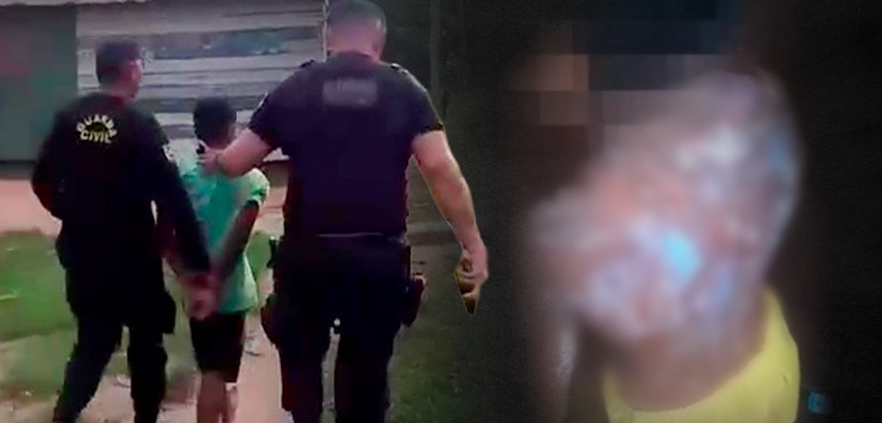 Homem é preso após queimar enteada de 6 anos com mingau quente em aldeia indígena no Amazonas