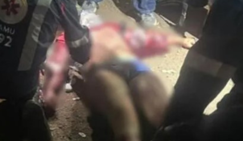 jovem tem orelha e braço dilacerados por pitbulls ao entregar pizza