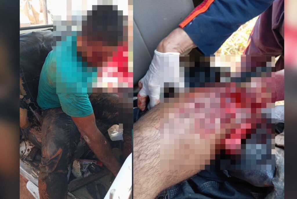 Motociclista fica com fratura exposta na perna durante acidente na zona rural de Sena Madureira