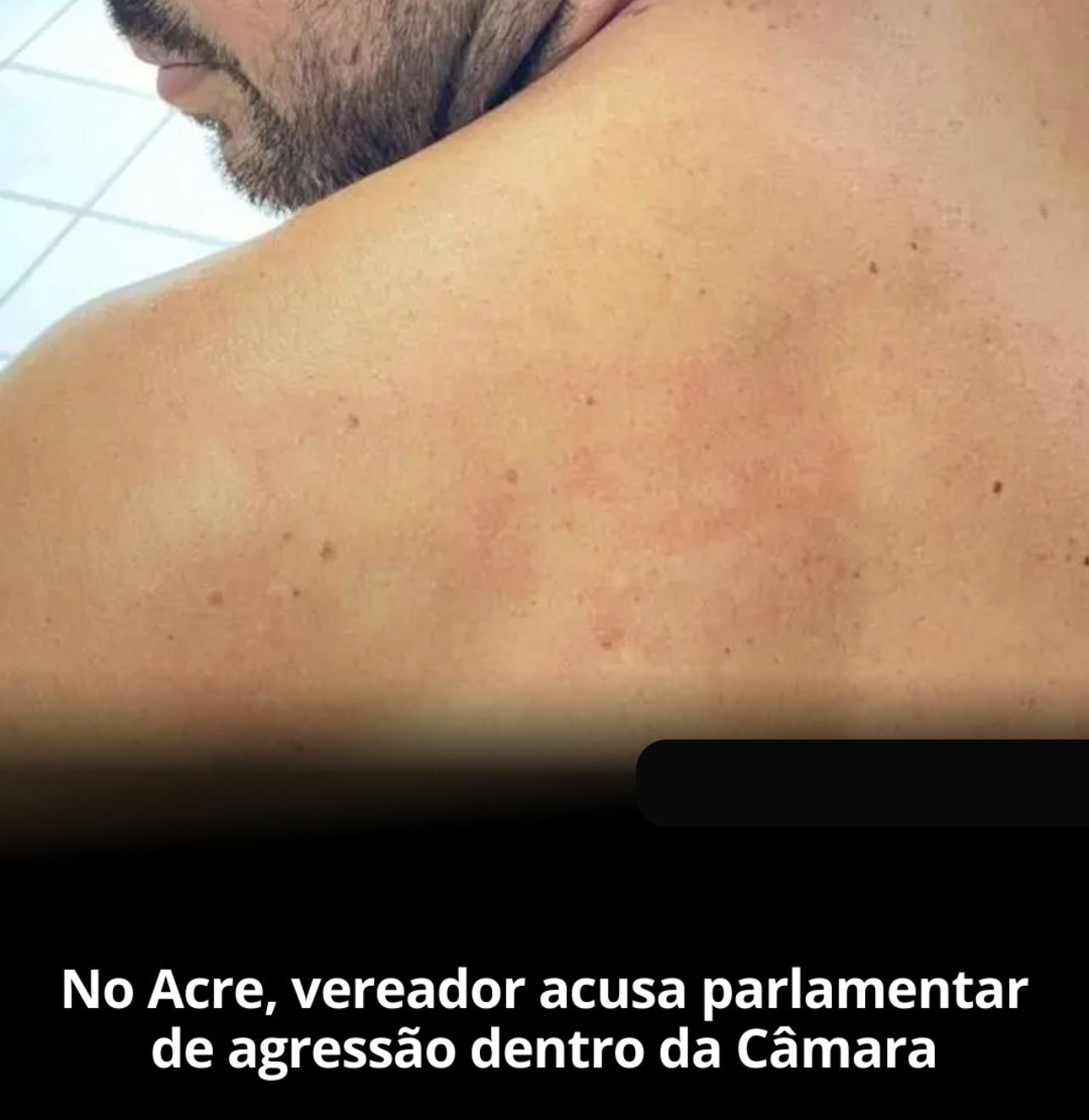 No Acre, vereador acusa parlamentar de agressão dentro da Câmara