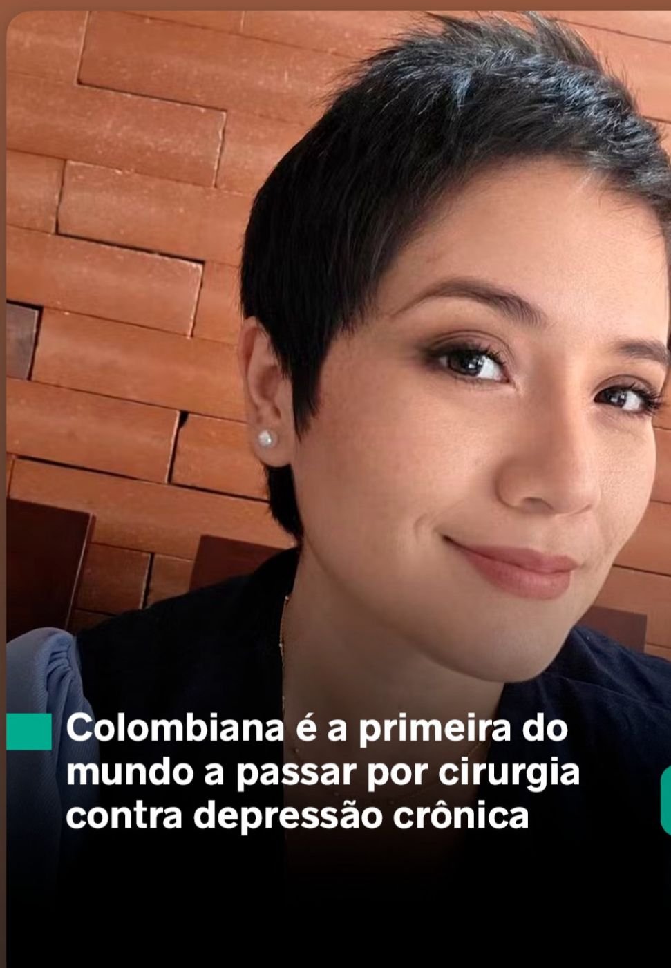 Cirurgia inédita devolve qualidade de vida a paciente após duas décadas de depressão e ansiedade