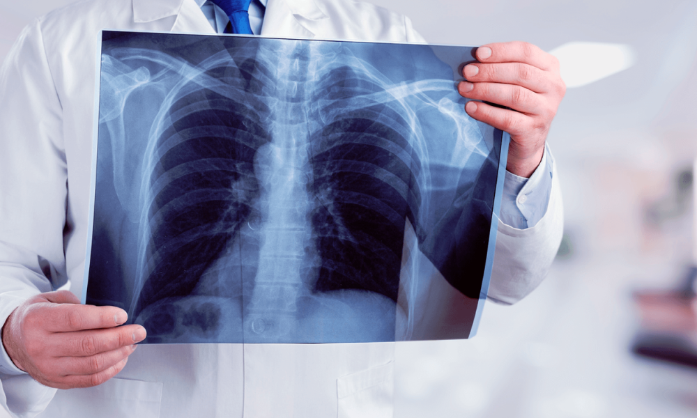 Estudo aponta que Acre está entre os estados com menor acesso à radiologia no Brasil