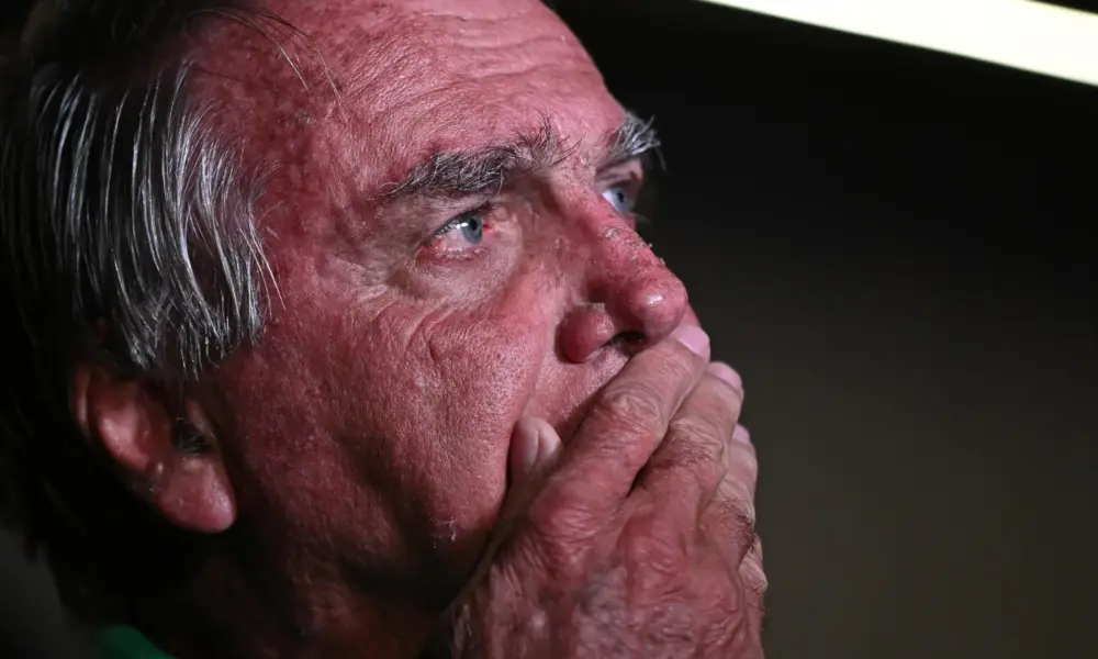 Bolsonaro recebe alta hospitalar; laudo aponta câncer de pele