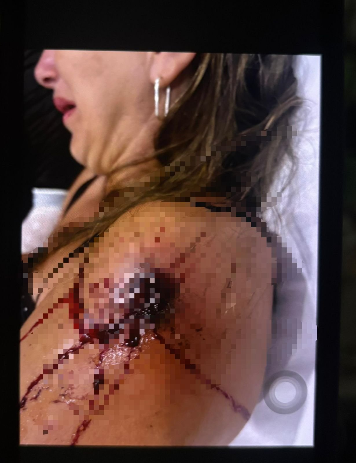 Mulher é baleada dentro de casa em Porto Walter