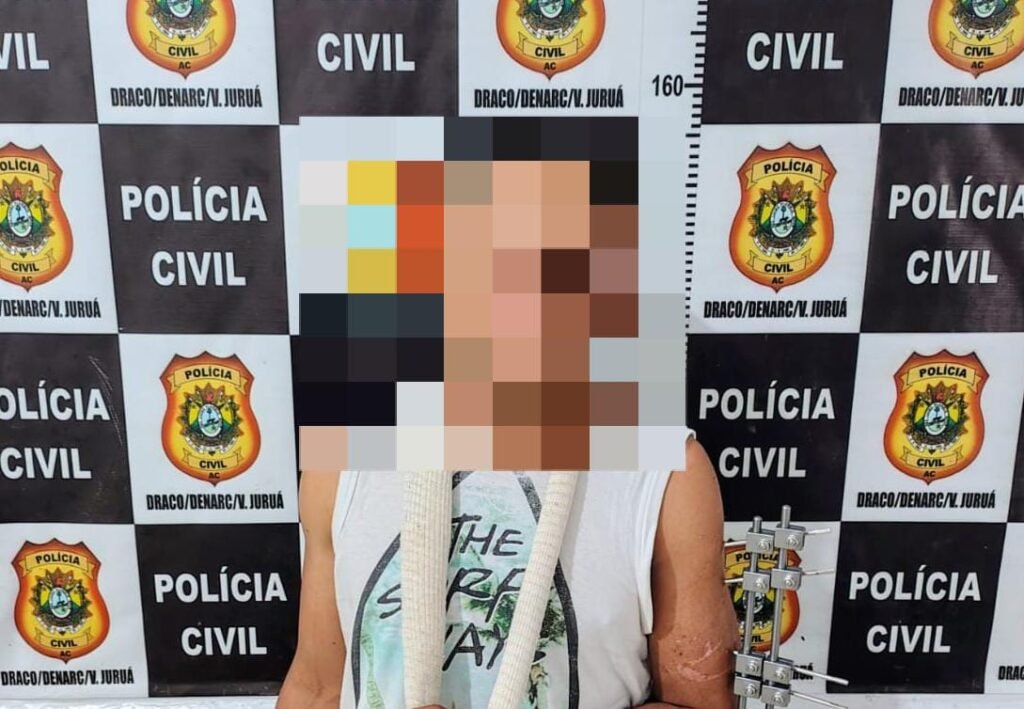 Homem é preso após furtar celular de mãe que acompanhava filha internada no Hospital do Juruá
