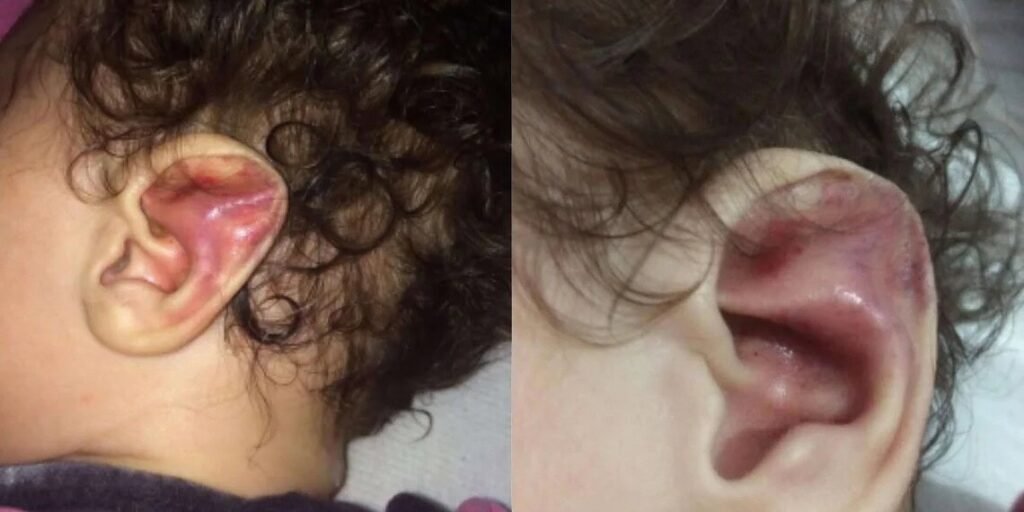 Mãe foragida por torturar e quebrar 6 costelas de filha bebê é presa