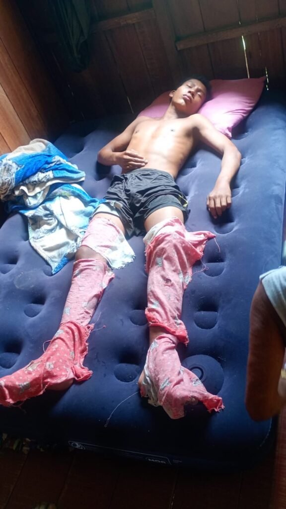 Adolescente de 15 anos é resgatado após passar cinco dias perdido na floresta em comunidade no Rio Breu, no Acre