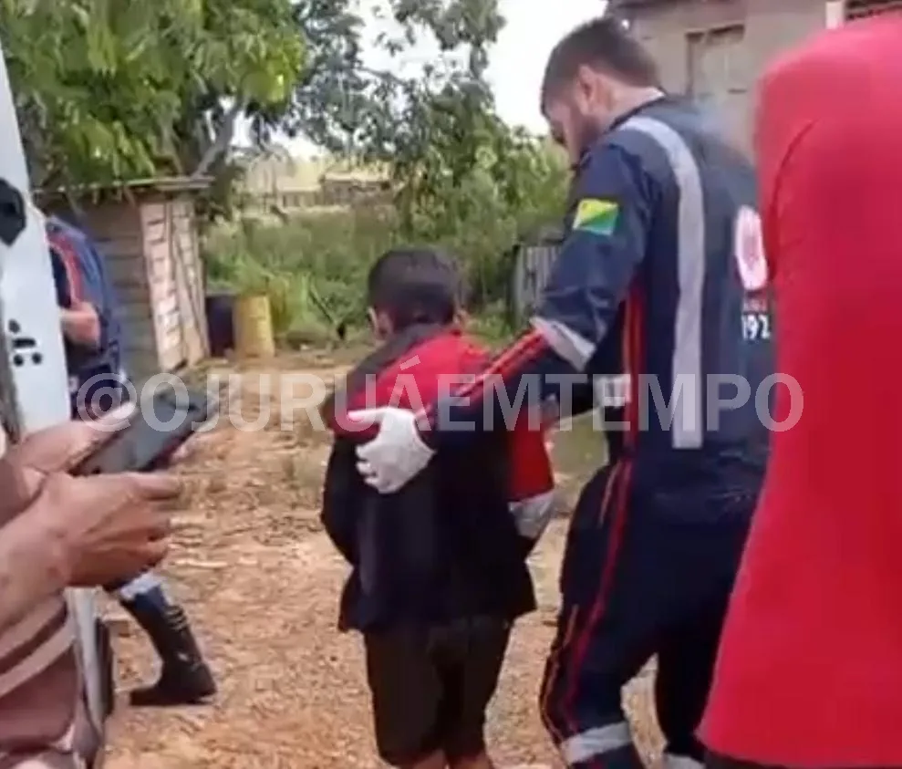 Menino de 10 anos é levado para Rio Branco após ser picado por cobra em comunidade rural; veja vídeo