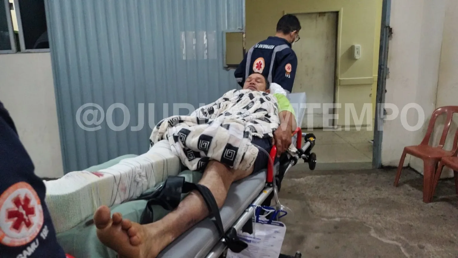 Homem sofre fratura exposta após queda de três metros enquanto retirava antena em Brasiléia