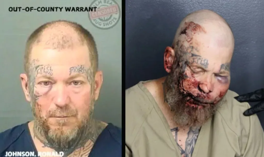 Homem chama policial para briga e leva a pior; veja antes e depois