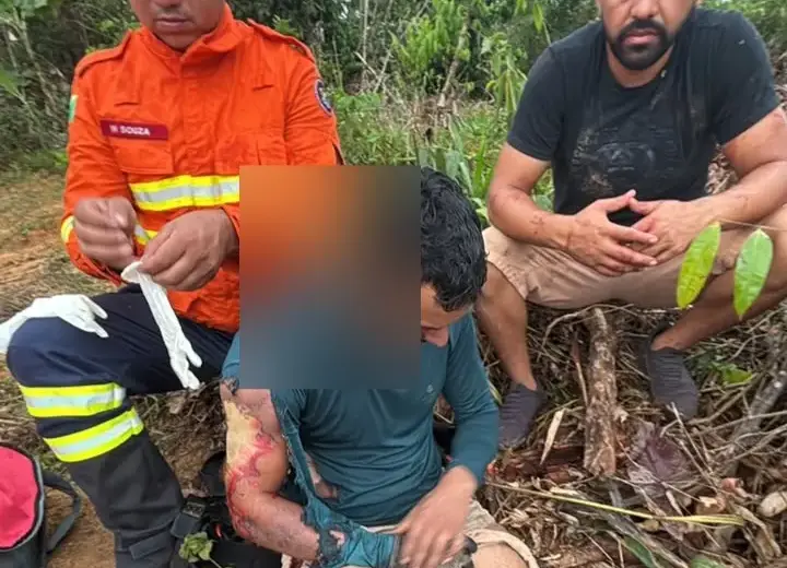 Trabalhador sofre descarga elétrica durante troca de transformador em Mâncio Lima