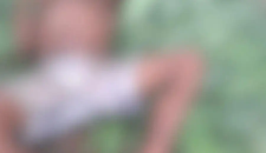 Trabalhador rural sofre grave ferimento após ser atingido por galho durante derrubada de árvores no Acre