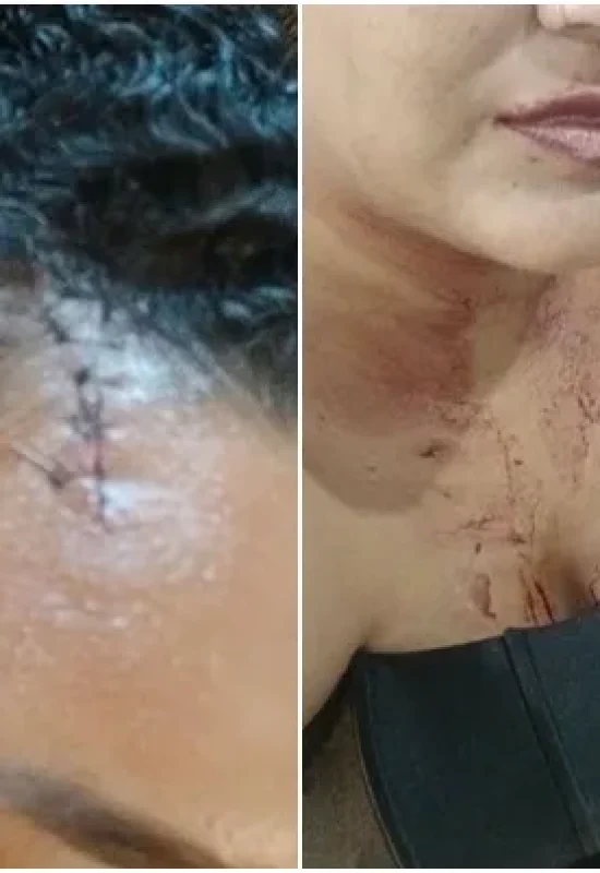 “Em nenhum momento eu toquei nele”: relata mulher agredida por militar durante a ExpoTarauacá