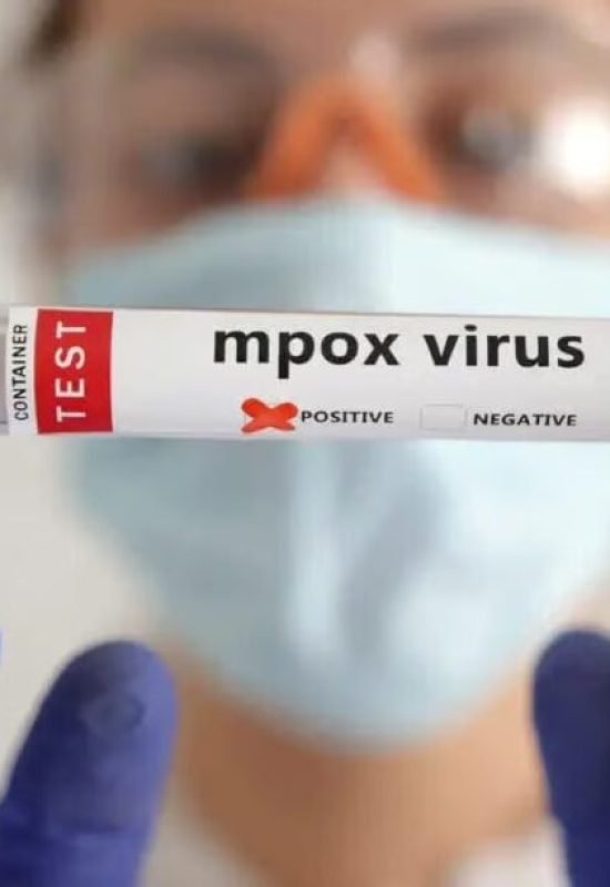 Suspeita de mpox é descartada após exames; paciente segue internada em Rio Branco