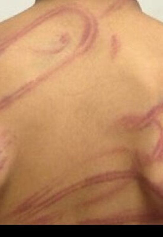 Pai é preso acusado de espancar filho de 12 anos em Cruzeiro do Sul