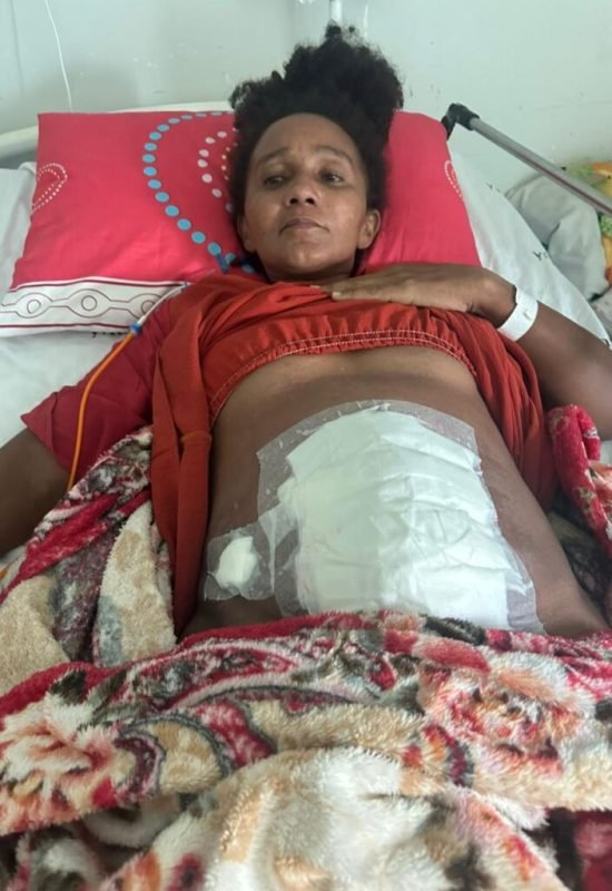 Moradora de Guajará passa por três cirurgias e pede apoio para alimentar os filhos