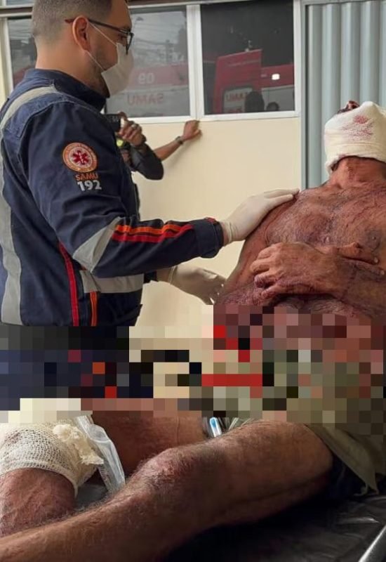Homem é atacado e ferido com golpes de terçado na zona rural de Porto Acre