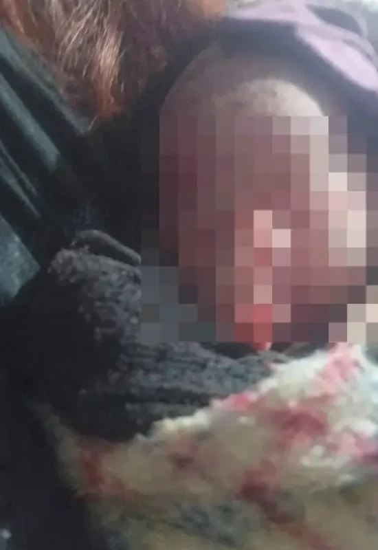 Mulher encontra bebê recém-nascida em saco de lixo no Paraná