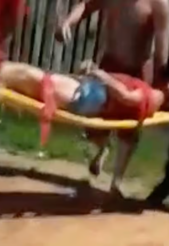 Mulher é ferida com facada no peito em Tarauacá; companheiro é suspeito